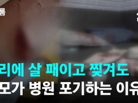 유리에 살 패이고 찢겨도…부모가 병원 포기하는 이유 / JTBC 뉴스룸
